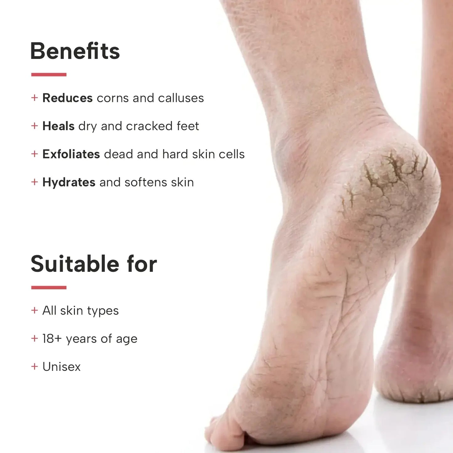Benefits of crack foot cream